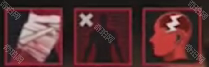 《暗区突围无限》异常状态处理方法3